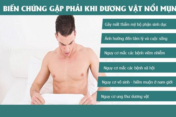 Tác hại của nổi mụn dương vật