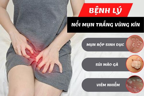Nổi mụn trắng cảnh báo nhiều bệnh lý khác nhau