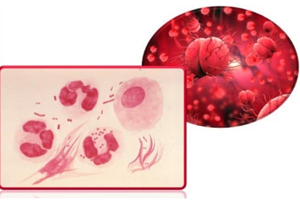 Lậu mãn tính là bệnh lý vô cùng nguy hiểm