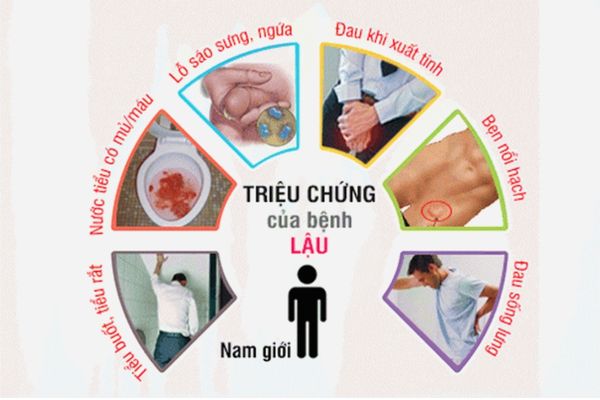 Dấu hiệu nhận biết bệnh lậu mãn tính ở nam giới