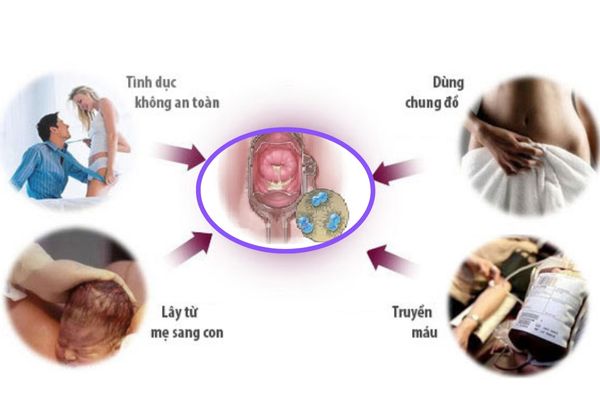 Bệnh lậu nữ giới lây nhiễm qua nhiều con đường khác nhau