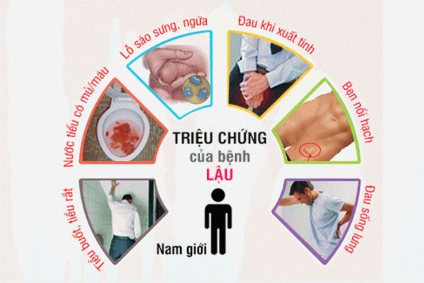 Dấu hiệu nhận biết bệnh lậu ở nam giới