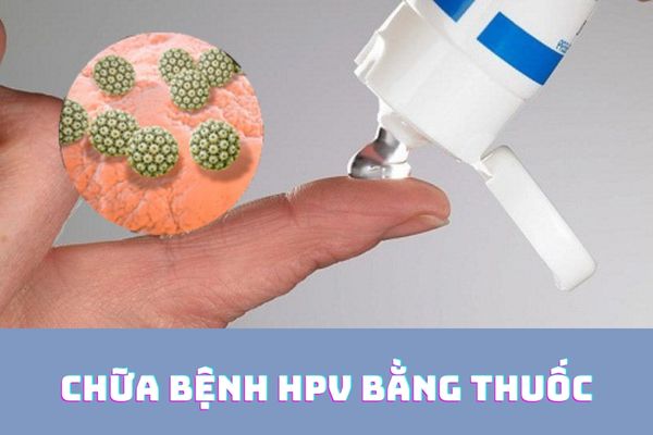 Chữa bệnh HPV hiệu quả bằng thuốc