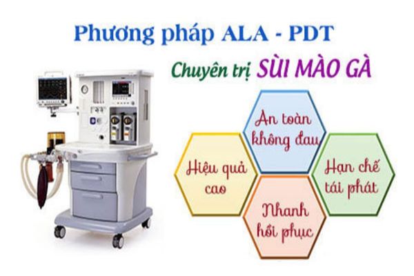 Điều trị sùi mào gà bằng phương pháp ALA - PDT