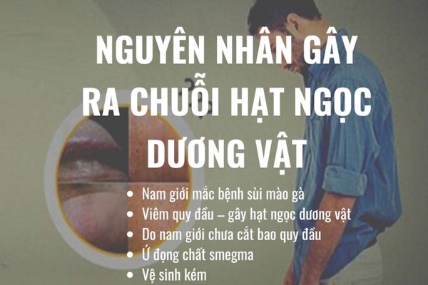 Có rất nhiều nguyên nhân dẫn đến chuỗi hạt ngọc dương vật