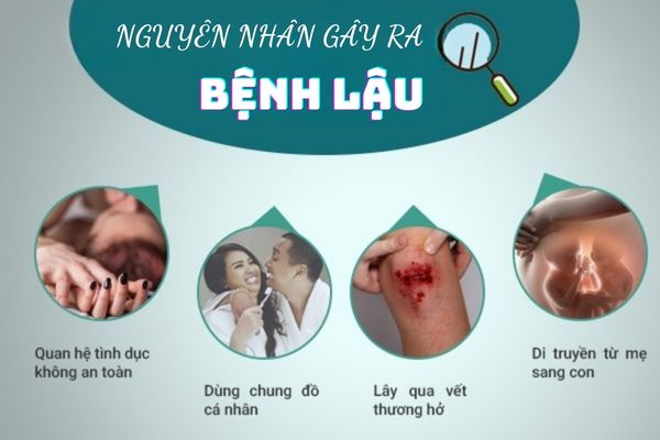 Có nhiều nguyên nhân gây bệnh lậu khác nhau