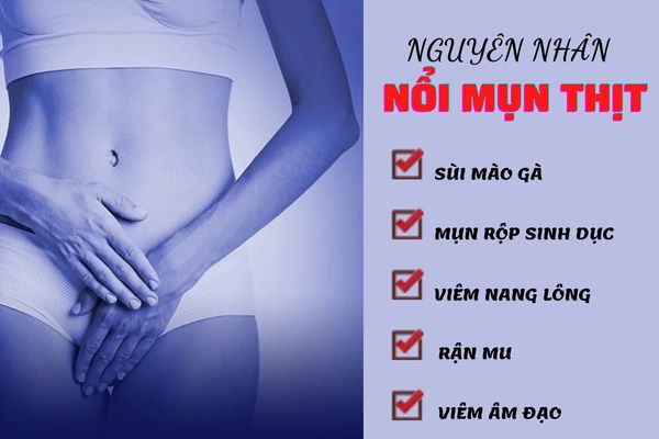 Nổi mụn thịt vùng kín cảnh báo cho nhiều bệnh lý nguy hiểm