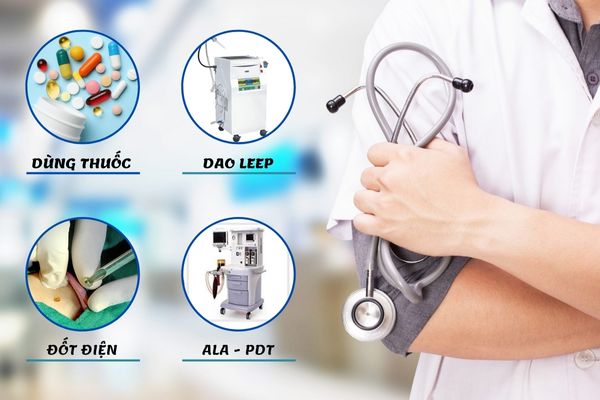 Phương pháp điều trị hiệu quả bệnh sùi mào gà giai đoạn đầu