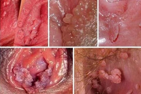 Sui-mao-ga-o-am-dao-2