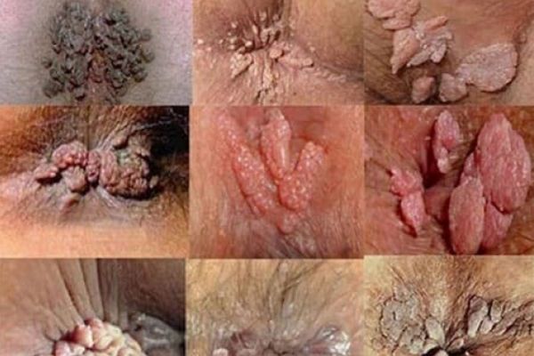 Sui-mao-ga-o-hau-mon-1