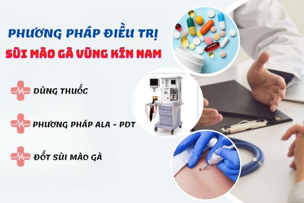 Phương pháp điều trị sùi mào gà vùng kín nam hiệu quả
