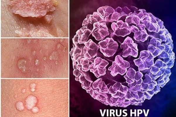 Cần xét nghiệm HPV khi phát hiện những dấu hiệu bất thường ở cơ thể