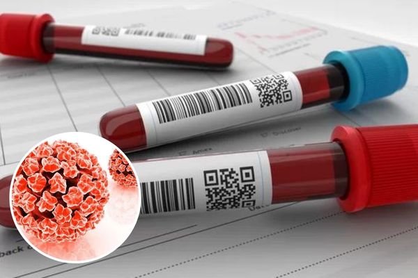 Xét nghiệm máu - Phương pháp kiểm tra HPV phổ biến