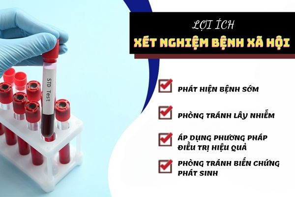 Xét nghiệm bệnh xã hội giúp phát hiện và điều trị bệnh hiệu quả