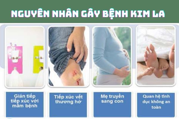 Bệnh kim la có thể lây nhiễm qua nhiều con đường khác nhau