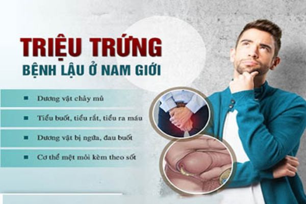 Triệu chứng bệnh kim la ở nam giới