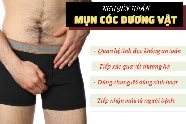 Nguyên nhân gây bệnh mụn cóc dương vật