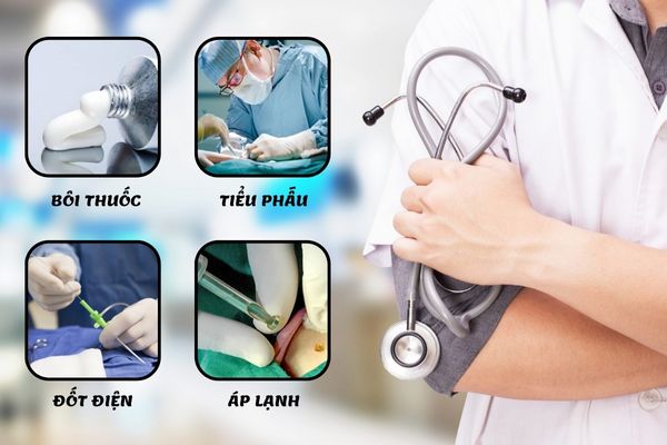 Phương pháp điều trị mụn cóc dương vật hiệu quả, an toàn