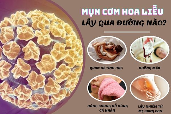 Mụn cơm hoa liễu lây truyền qua nhiều con đường khác nhau