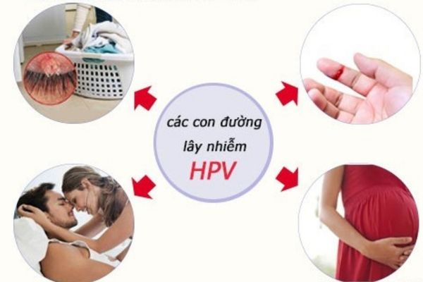 Mụn cơm vùng kín lây nhiễm qua nhiều con đường khác nhau