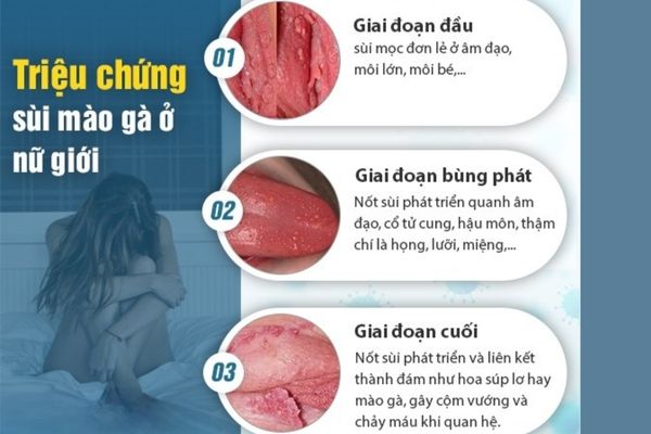 Nổi mụn âm đạo là triệu chứng điển hình của bệnh sùi mào gà