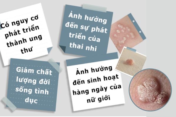 Mụn cóc vùng kín gây nhiều ảnh hưởng đến sức khỏe của người bệnh