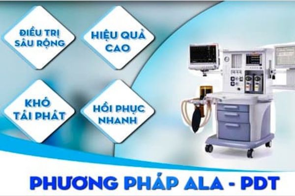Phương pháp ALA- PDT - Hỗ trợ điều trị mụn cóc vùng kín hiệu quả