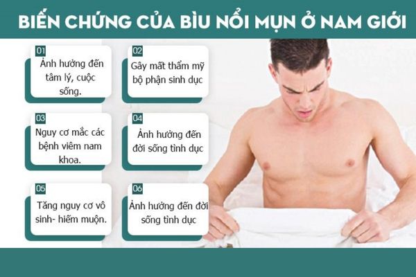 Bìu nổi mụn gây ra nhiều biến chứng nguy hiểm đối với sức khỏe