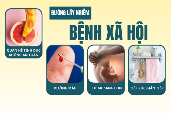 Thong-tin-benh-xa-hoi-o-nam-va-nu-can-luu-y-5