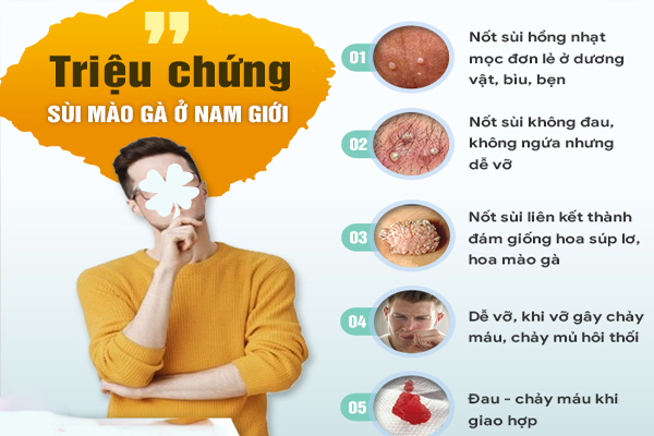 Nhận biết dấu hiệu sùi mào gà ở nam giới