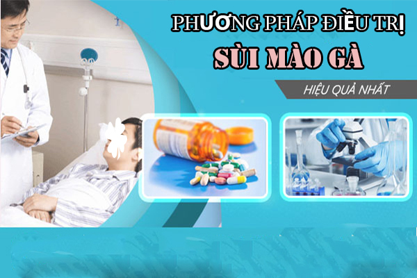 Điều trị sùi mào gà ở lỗ sáo hiệu quả tại Phòng Khám Hải Dương