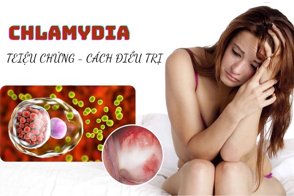 Chlamydia là bệnh gì? Nguyên nhân, triệu chứng và cách điều trị