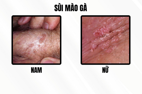 z5312239635985_7403f00c8dc0292a125aa5069e45fbde