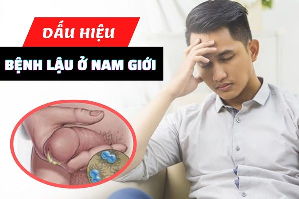 Dấu hiệu nhận biết bệnh lậu ở nam giới cần lưu ý