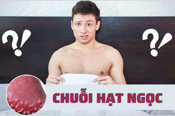 Nam giới xuất hiện chuỗi hạt ngọc dương vật có nguy hiểm không?