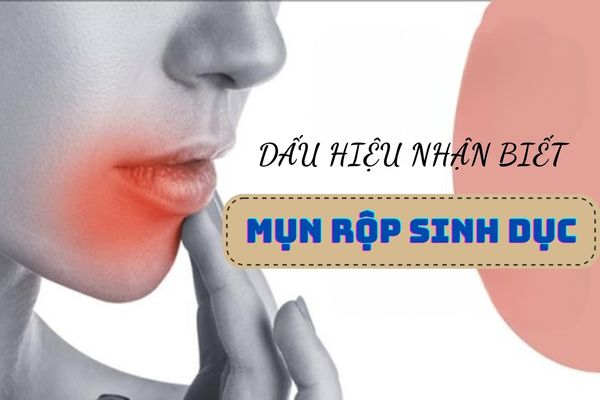 Dấu hiệu nhận biết mụn rộp sinh dục hiệu quả
