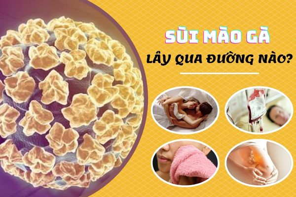 Sùi mào gà lây qua đường nào? Có nguy hiểm không?