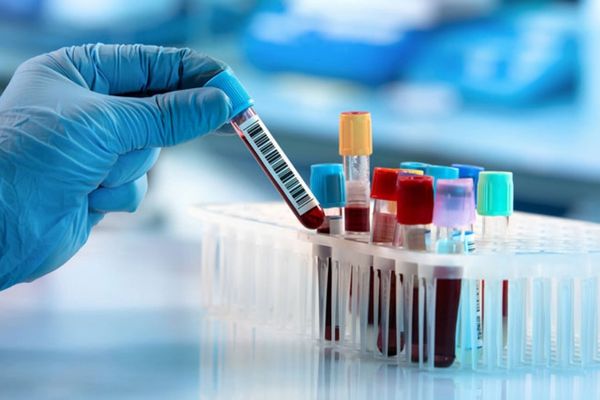 Xét nghiệm máu là phương pháp thông dụng nhất