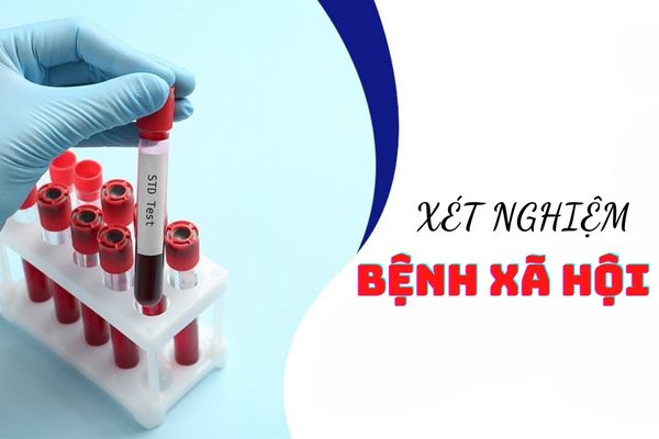 Phương pháp xét nghiệm bệnh xã hội hiệu quả và an toàn