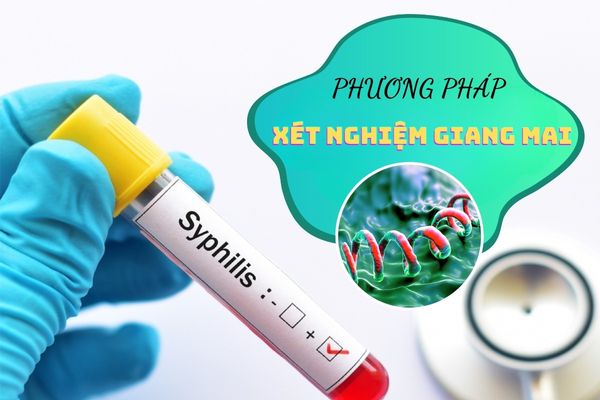 Những điều cần biết về các phương pháp xét nghiệm giang mai
