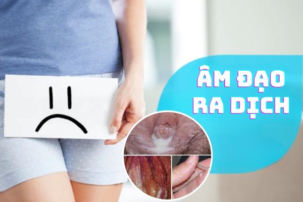 Âm đạo ra dịch bất thường – Dấu hiệu nhận biết bệnh lý nguy hiểm