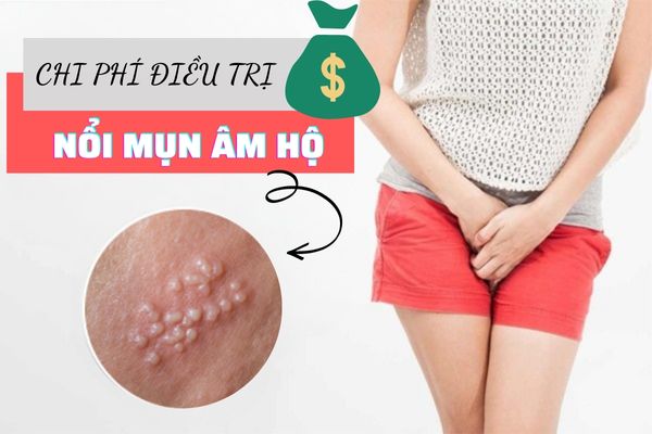 Chi phí điều trị nổi mụn âm hộ hết bao nhiêu tiền?