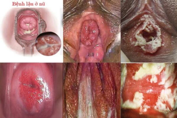 Vung-kin-chay-dich-1