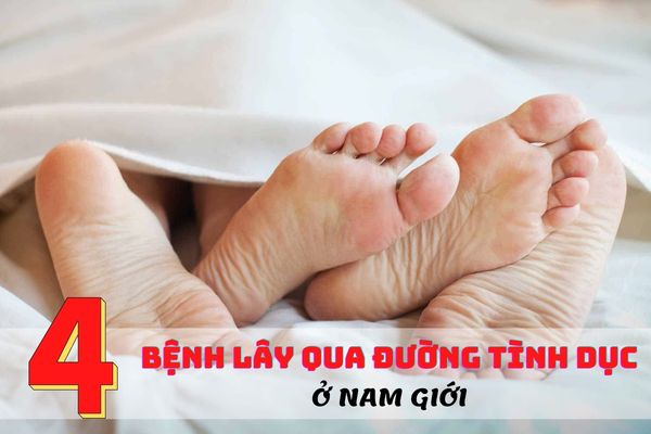 4 bệnh lây qua đường tình dục phổ biến ở nam giới
