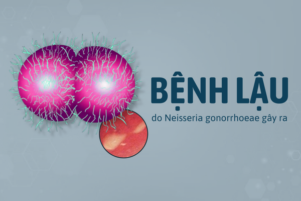 Benh-lau-su-am-uot-tiem-an-nguy-hiem-khon-luong-0