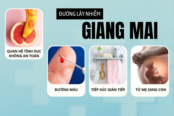 Nguyên nhân bệnh giang mai và dấu hiệu nhận biết sớm