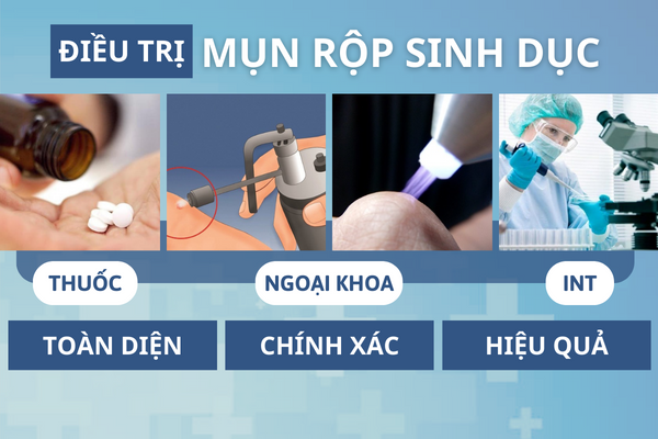 Mun-rop-sinh-duc-tuong-mun-mu-don-gian-nhung-lai-cuc-nguy-hiem-4