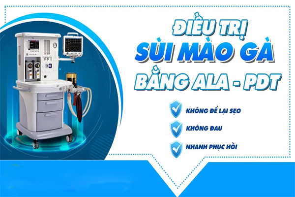 Điều trị sùi mào gà hiệu quả tại Phòng Khám Hải Dương ở Hải Dương
