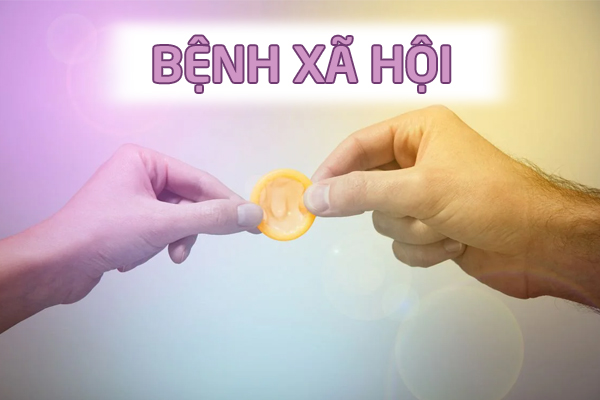 Chữa bệnh xã hội bằng phương pháp nào hiệu quả?