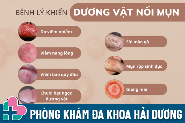 Duong-vat-noi-mun-la-do-dau-va-dieu-tri-ra-sao-4